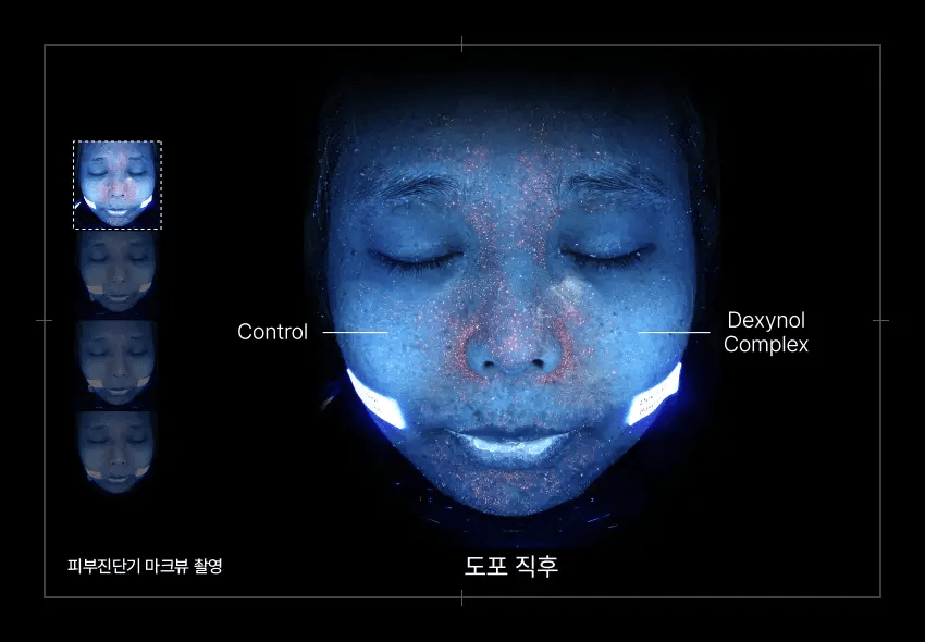 Dexynol-16.3™ Advanced Skincare Set